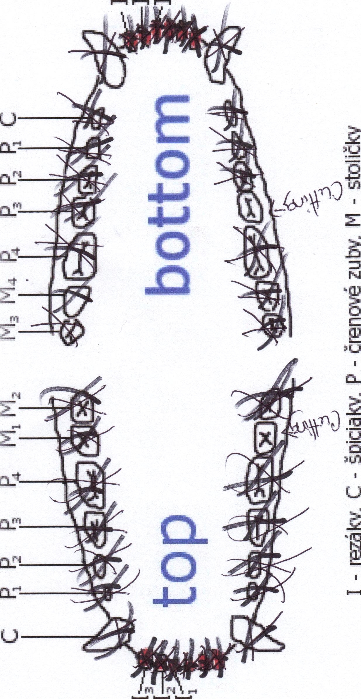 dental schema from Becky confirming his complete dentition