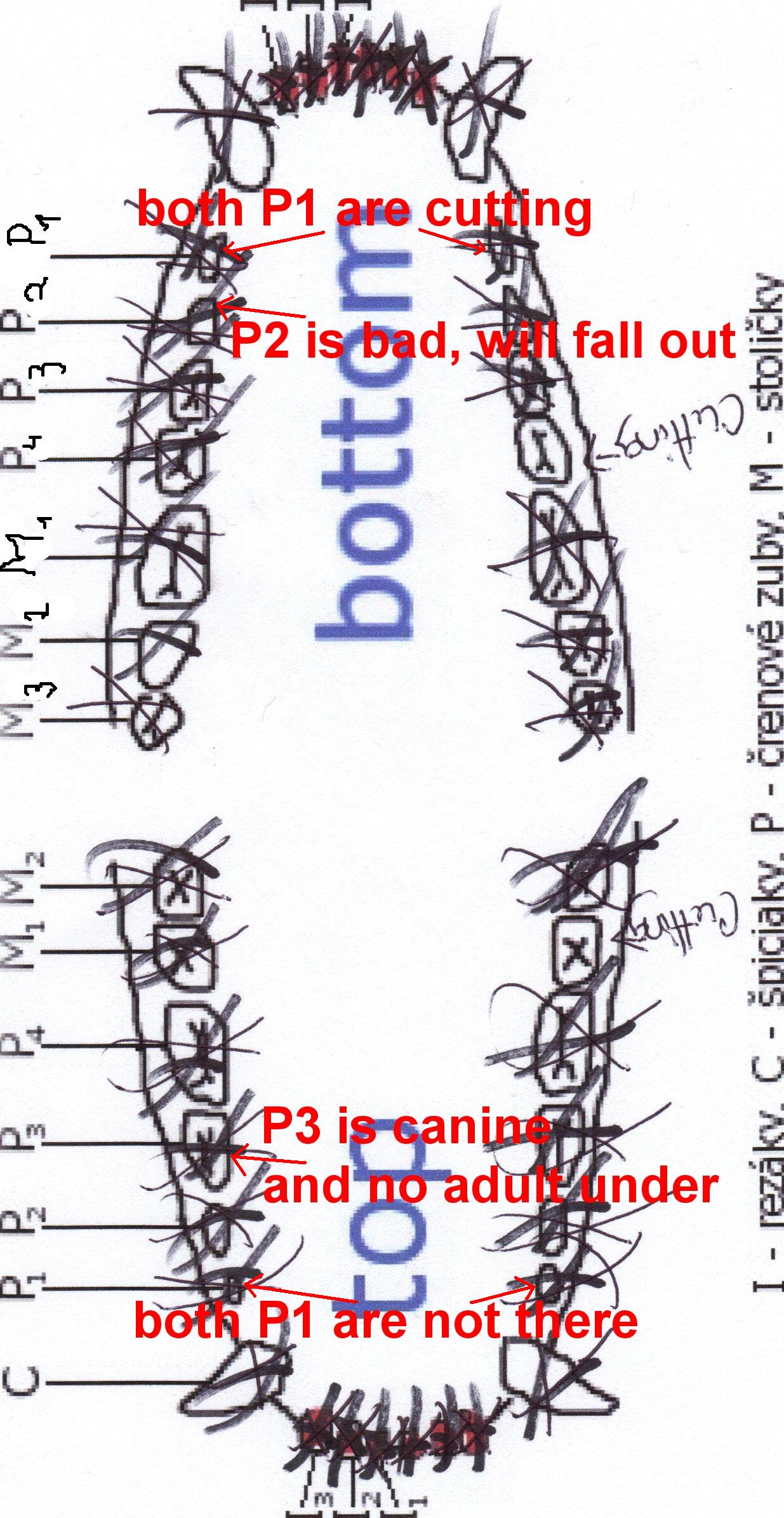 dental schema of his real teeth