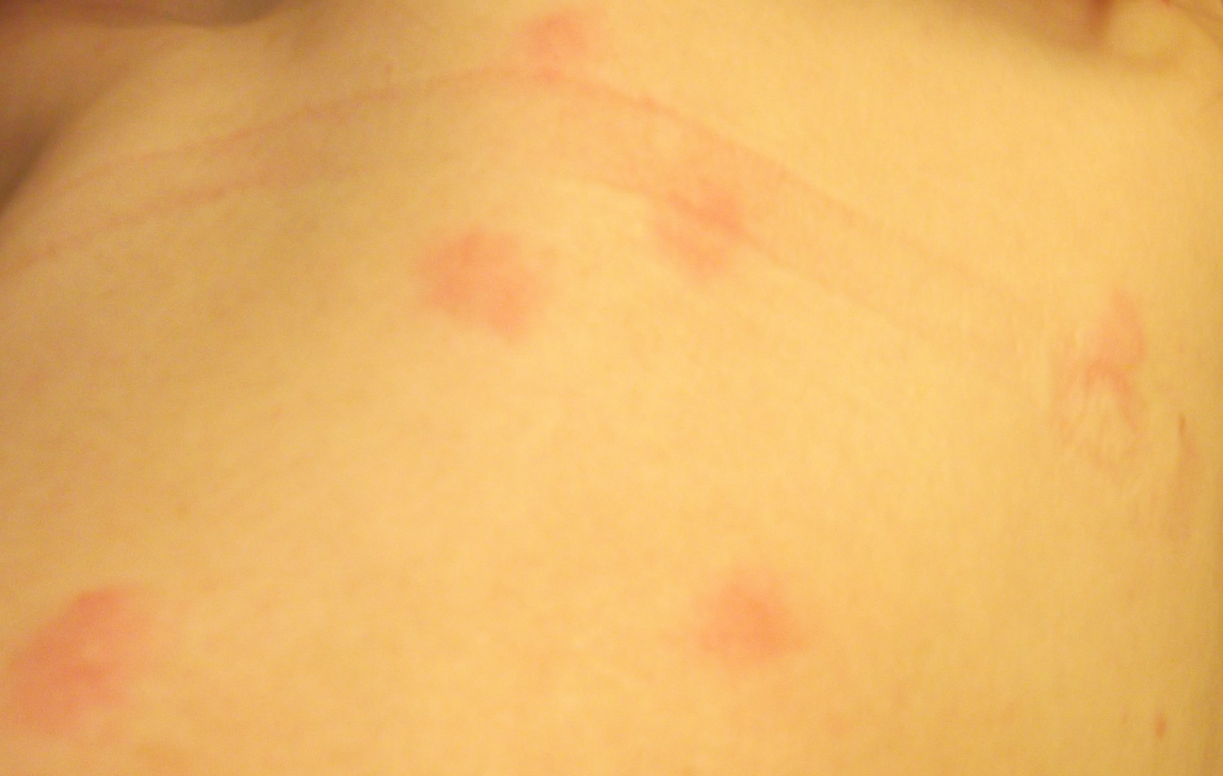 latest bites on just one shoulder