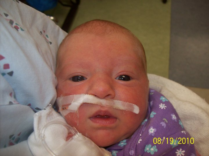 Our precious baby on a feeding tube