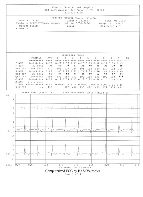 Heart Electrocardiogram