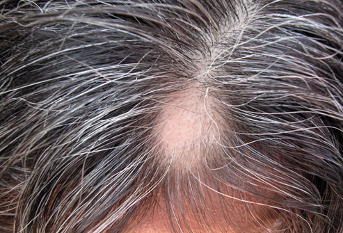 Used the GRAY INHIBITOR from "Funky Mommy" bought on: http://www.funkymommy.net/grayinhibitor.html
My hair became more grey and bald patches appeared, this is pure scam, they just ignored all my messa