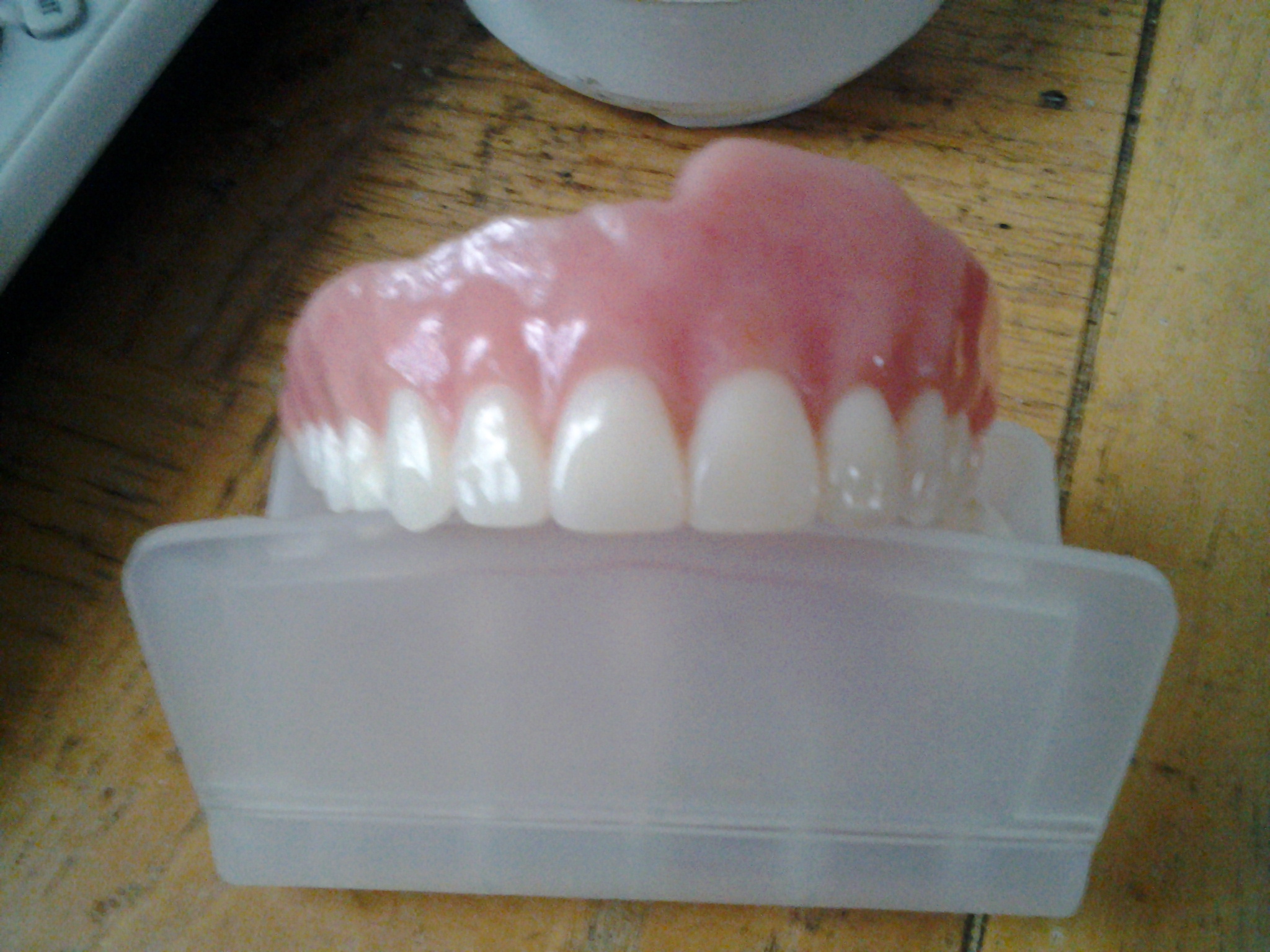 Terrible dentures. I have other pictures and a video to.
