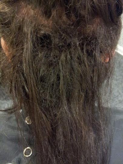 Image of back of client's head before the extension was removed, where the hair had matted together.

The hair was so matted that you could not see her scalp, nor where the hair was sewn. It was impos