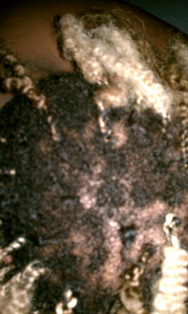 Alleged photo from Tawana saying that I burnt her hair. As you can see it is stolen from a Yelp review of a hair braiding salon in Chicago.