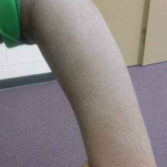 my son was left in the care of department and Children Services with his arm in this condition it was asked you white and he's a brown boy no disrespect we love everybody