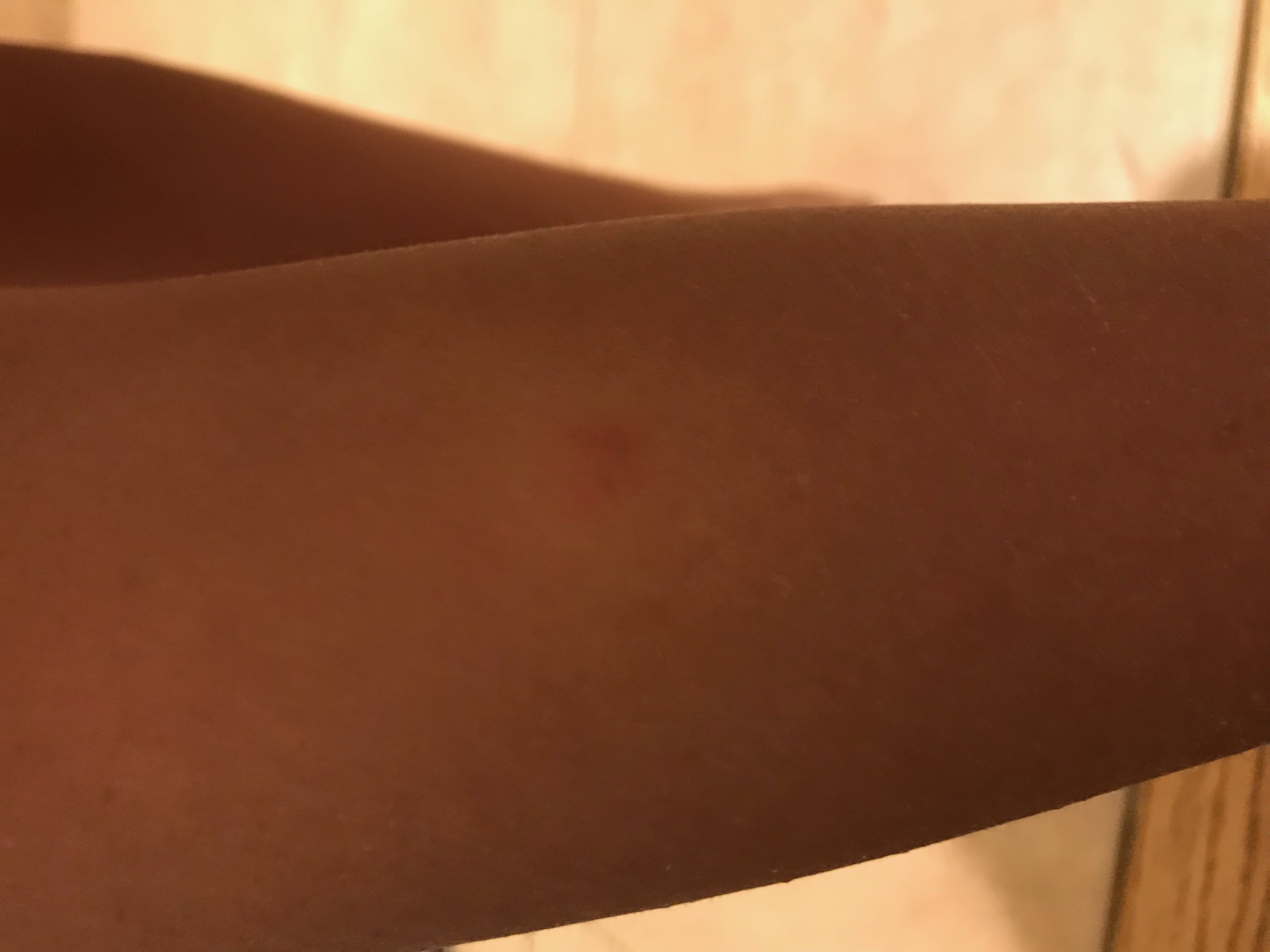 Bug bite on leg from BW hotel