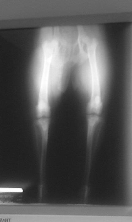 The xray that is backwards