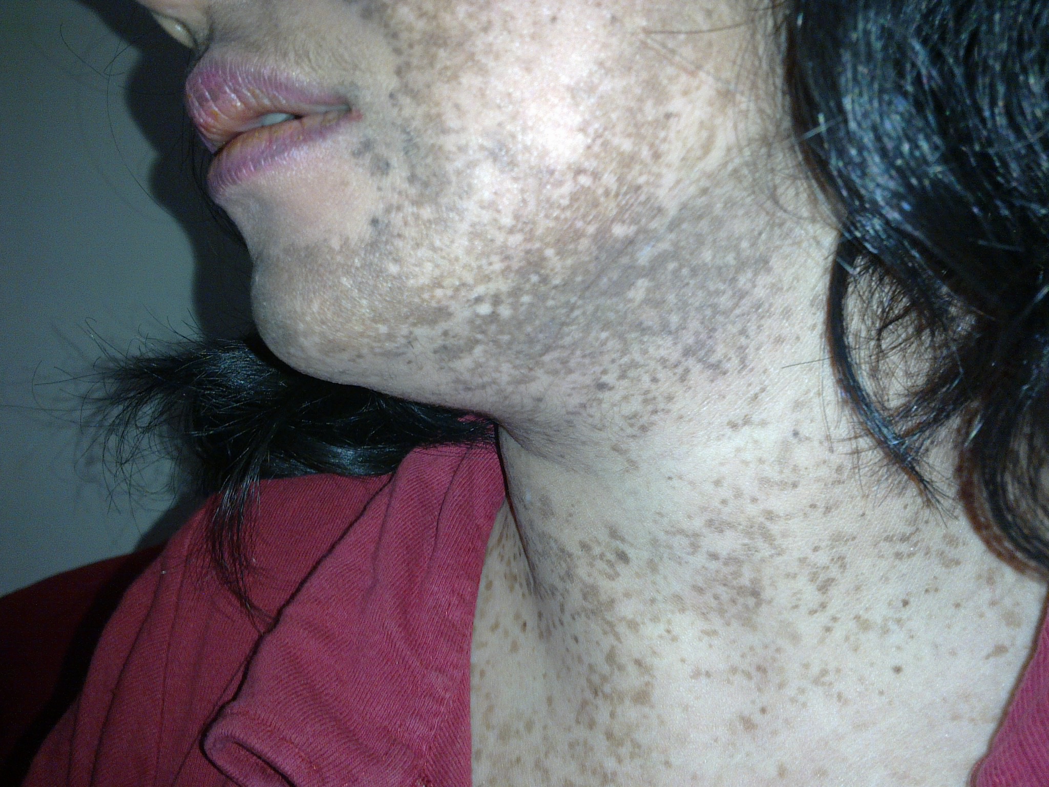 Disfigured skin by using the Funky Mommy products 