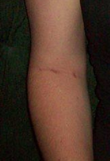 Here is a close up of her right arm, all veins blown out...