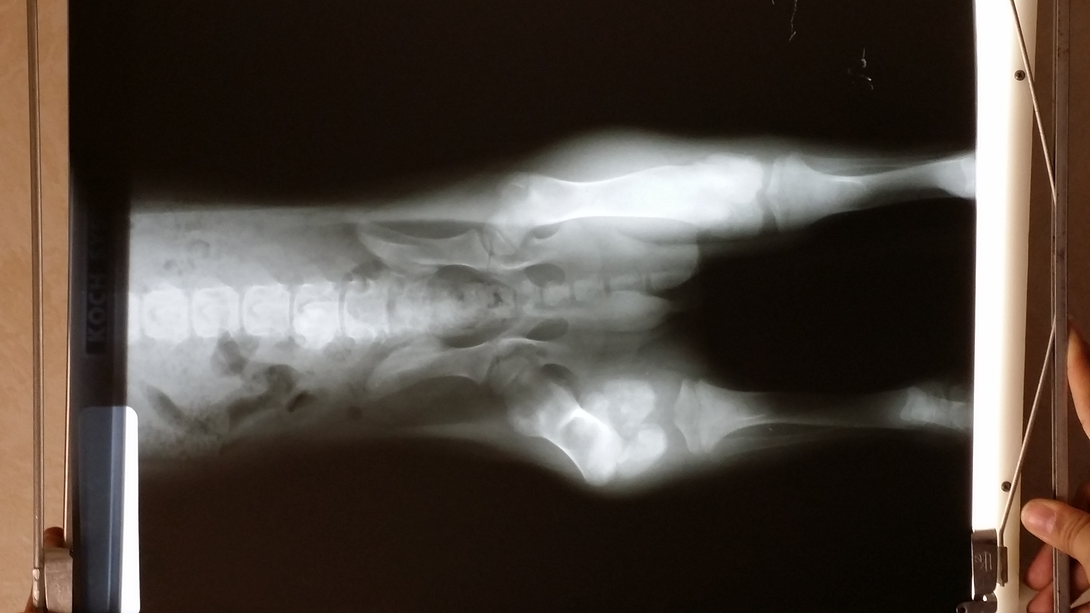 Broken Leg Xray