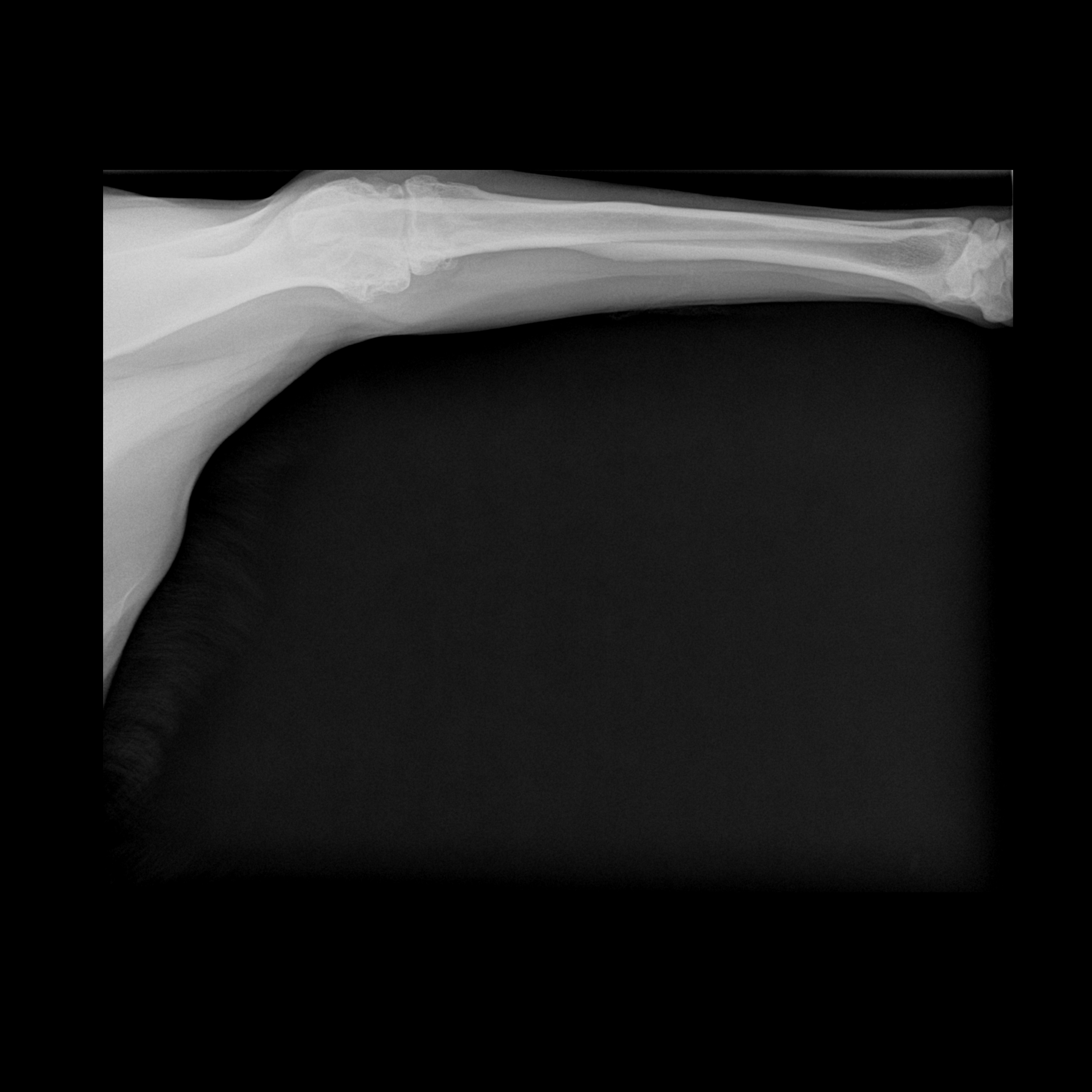 Elbow radiograph