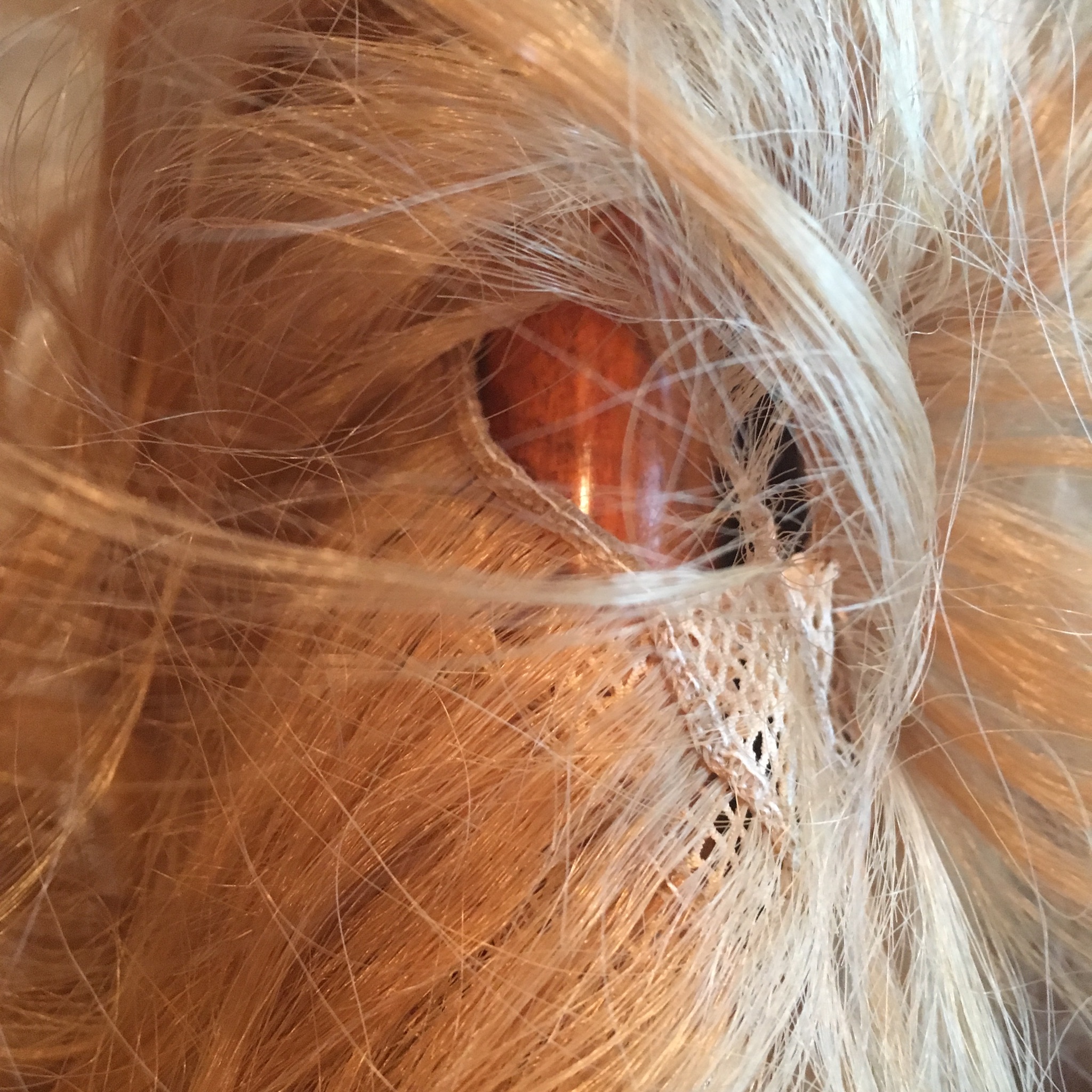 holes in scalp